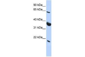 WB Suggested Anti-SRPR Antibody Titration:  0.