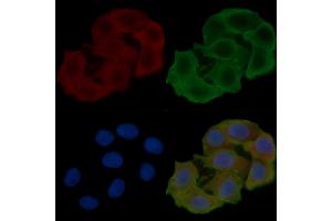 ABIN6261856 and ABIN6266542 staining Hela cells(24h of starvation treatment) by IF/ICC.
