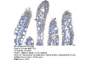 Rabbit Anti-OTC Antibody  Paraffin Embedded Tissue: Human Intestine Cellular Data: Epithelial cells of intestinal villas Antibody Concentration: 4. (OTC Antikörper  (N-Term))