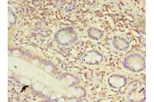 Immunohistochemistry of paraffin-embedded human small intestine tissue using ABIN7164351 at dilution of 1:100 (DDX31 Antikörper  (AA 560-851))