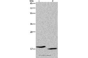 Western blot analysis of MCF-7 and Hela cell, using KLLN Polyclonal Antibody at dilution of 1:350