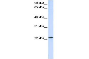 RAB18 antibody used at 1 ug/ml to detect target protein.