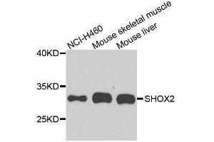 Western blot analysis of extracts of various cell lines, using SHOX2 antibody. (SHOX2 Antikörper  (AA 96-355))