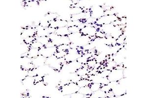 Immunohistochemistry of paraffin embedded mouse lung using ZKSCAN4 (ABIN7076265) at dilution of 1:1300 (400x lens) (ZKSCAN4 Antikörper)