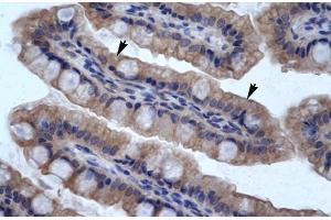 Human Intestine; SMPDL3B antibody - N-terminal region in Human Intestine cells using Immunohistochemistry (SMPDL3B Antikörper  (N-Term))