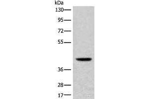 Western blot analysis of Mouse liver tissue lysate using USP12 Polyclonal Antibody at dilution of 1:700 (USP12 Antikörper)