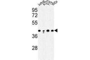 Western Blotting (WB) image for anti-Calcium Activated Nucleotidase 1 (CANT1) antibody (ABIN3003928) (CANT1 Antikörper)