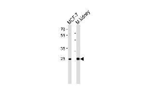 Western blot analysis of lysates from MCF-7 cell line and mouse kidney tissue lysate (from left to right), using CA2 Antibody at 1:1000 at each lane. (CA2 Antikörper  (N-Term))