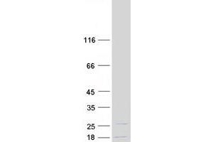 Western Blotting (WB) image for Nuclear Import 7 Homolog (NIP7) protein (Myc-DYKDDDDK Tag) (ABIN2727312)