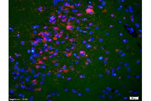 Formalin-fixed and paraffin-embedded rat brain labeled with Anti-KIF5A/NKHC1 Polyclonal Antibody, Unconjugated (ABIN1387674) 1:200, overnight at 4°C, The secondary antibody was Goat Anti-Rabbit IgG, Cy3 conjugated used at 1:200 dilution for 40 minutes at 37°C. (K5A/ NKHC1 (AA 201-300) Antikörper)