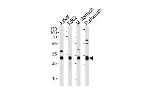 Western blot analysis of lysates from Jurkat, K562 cell line, mouse stomach and rat stomach tissue (from left to right), using ESD Antibody (Center) (ABIN1882167 and ABIN2838493). (Esterase D Antikörper  (AA 68-102))