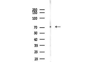 Western blot analysis of lysates from COLO205 cells(UV,30 min treatment), using DDX43 Antibody at 1/1000 dilution.