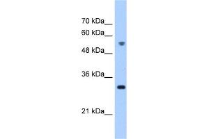 WB Suggested Anti-TTC5 Antibody Titration:  0. (TTC5 Antikörper  (C-Term))