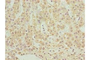 Immunohistochemistry of paraffin-embedded human adrenal gland tissue using ABIN7170079 at dilution of 1:100