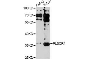 Western blot analysis of extracts of various cell lines, using PLSCR4 antibody (ABIN6291579) at 1:3000 dilution. (PLSCR4 Antikörper)