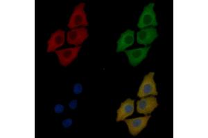 YTHDF3 Mouse Monoclonal Antibody staining Hela cells by IF/ICC. (YTHDF3 Antikörper)