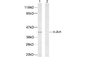 Western blot analysis of extracts from NIH/3T3 cells treated with UV. (C-JUN Antikörper  (Ser63))