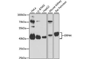 Western blot analysis of extracts of various cell lines, using ERP44 antibody (ABIN1679753, ABIN3019013, ABIN3019014 and ABIN6220673) at 1:3000 dilution. (ERP44 Antikörper  (AA 57-406))