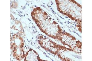 Immunohistochemistry of paraffin-embedded Human stomach using CXCL12 Polyclonal Antibody at dilution of 1:100 (40x lens).