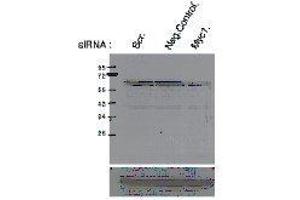 Western Blotting (WB) image for anti-Myc Proto-Oncogene protein (MYC) (pSer62) antibody (ABIN3201011) (c-MYC Antikörper  (pSer62))