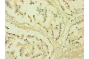 Immunohistochemistry of paraffin-embedded human prostate tissue using ABIN7161023 at dilution of 1:100 (POR Antikörper  (AA 2-671))