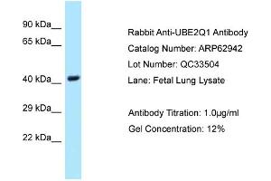 Western Blotting (WB) image for anti-Ubiquitin-Conjugating Enzyme E2Q Family Member 1 (UBE2Q1) (Middle Region) antibody (ABIN2789308) (UBE2Q1 Antikörper  (Middle Region))