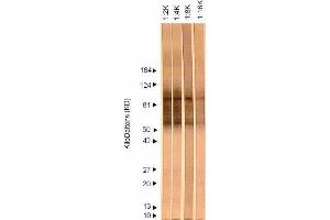 Western Blotting (WB) image for anti-Herpes Simplex Virus Type 2, Glycoprotein G (HSV2 gG) antibody (ABIN265564) (HSV-2 gG Antikörper)