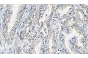 ABIN6276720 at 1/100 staining Human prostate tissue by IHC-P. (Phenylalanine Hydroxylase Antikörper  (N-Term))