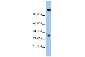 WB Suggested Anti-ZSWIM3 Antibody Titration: 0. (ZSWIM3 Antikörper  (N-Term))