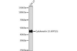 Western blot analysis of extracts of Cal-27 cells, using Cytokeratin 15 (KRT15) (KRT15) antibody (ABIN7268093) at 1:1000 dilution. (KRT15 Antikörper)
