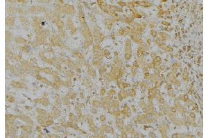 ABIN6272963 at 1/100 staining Mouse liver tissue by IHC-P. (LONP1 Antikörper  (C-Term))