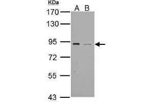 WB Image Sample (30 ug of whole cell lysate)  A: NT2D1 B:  PC-3 7. (PDE4B Antikörper  (C-Term))