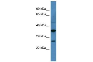 WB Suggested Anti-Cacng1 Antibody Titration: 0. (CACNG1 Antikörper  (N-Term))