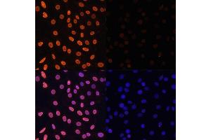 Immunofluorescence analysis of C6 cells using Acetyl-Histone H3-K36 antibody (ABIN7267671) at dilution of 1:100. (Histone 3 Antikörper  (H3K36))
