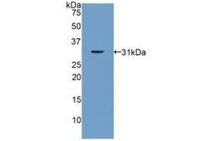 Detection of Recombinant PNMA2, Rat using Polyclonal Antibody to Paraneoplastic Antigen MA2 (PNMA2) (PNMA2 Antikörper  (AA 74-333))