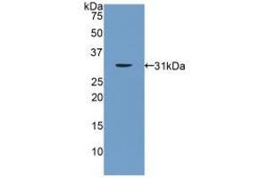 Detection of Recombinant PNMA2, Rat using Polyclonal Antibody to Paraneoplastic Antigen MA2 (PNMA2)