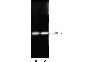 Western blot analysis of Proteasome 19S ATPase subunit Rpt6, mAb (p45-110) . (Proteasome 19S Rpt6/S8 Subunit Antikörper)