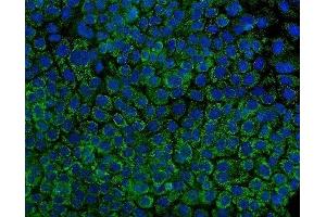 IF analysis of Tryptophan Hydroxylase/TPH1 using anti-Tryptophan Hydroxylase/TPH1 antibody (ABIN7601556). (Tryptophan Hydroxylase 1 Antikörper  (AA 383-444))