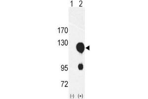 Western Blotting (WB) image for anti-Receptor Tyrosine Kinase-Like Orphan Receptor 2 (ROR2) (AA 19-50) antibody (ABIN3032442)