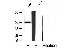 Western blot analysis of extracts of HepG2 cells, using SQRDL antibody. (SQRDL Antikörper)