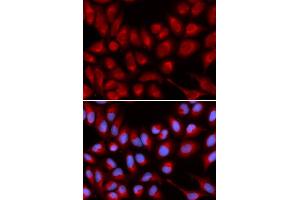 Immunofluorescence analysis of U2OS cell using IL16 antibody. (IL16 Antikörper)