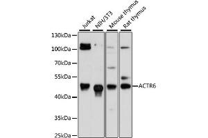 Western blot analysis of extracts of various cell lines, using  antibody (ABIN6133271, ABIN6136499, ABIN6136500 and ABIN6217149) at 1:3000 dilution. (ACTR6 Antikörper  (AA 237-396))