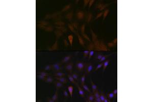 Immunofluorescence analysis of C6 cells using MEK3 Rabbit mAb (ABIN1682965, ABIN3017630, ABIN3017631 and ABIN7101512) at dilution of 1:100 (40x lens). (MAP2K3 Antikörper)