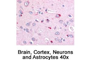 Image no. 1 for anti-Niemann-Pick Disease, Type C1 (NPC1) (C-Term) antibody (ABIN363474) (NPC1 Antikörper  (C-Term))