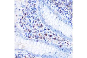 Immunohistochemistry of paraffin-embedded human appendix using Bcl-2 Rabbit pAb (ABIN6134233, ABIN6137496, ABIN6137498 and ABIN6213667) at dilution of 1:100 (40x lens). (Bcl-2 Antikörper)