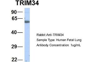 Host:  Rabbit  Target Name:  TRIM34  Sample Type:  Human Fetal Lung  Antibody Dilution:  1. (TRIM34 Antikörper  (N-Term))