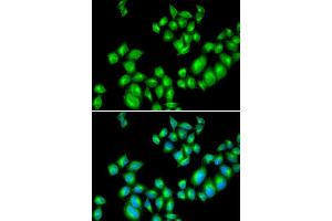 Immunofluorescence analysis of U20S cell using DRD3 antibody. (DRD3 Antikörper  (AA 213-329))
