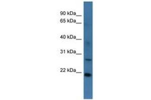 Image no. 1 for anti-StAR-Related Lipid Transfer (START) Domain Containing 4 (STARD4) (AA 96-145) antibody (ABIN6746357) (STARD4 Antikörper  (AA 96-145))
