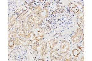 Immunohistochemistry analysis of paraffin-embedded Human spleen using LC3A/B Polyclonal Antibody at dilution of 1:500. (LC3A / LC3B Antikörper)