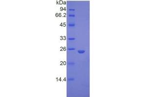 SDS-PAGE analysis of Mouse Glypican 4 Protein. (GPC4 Protein)